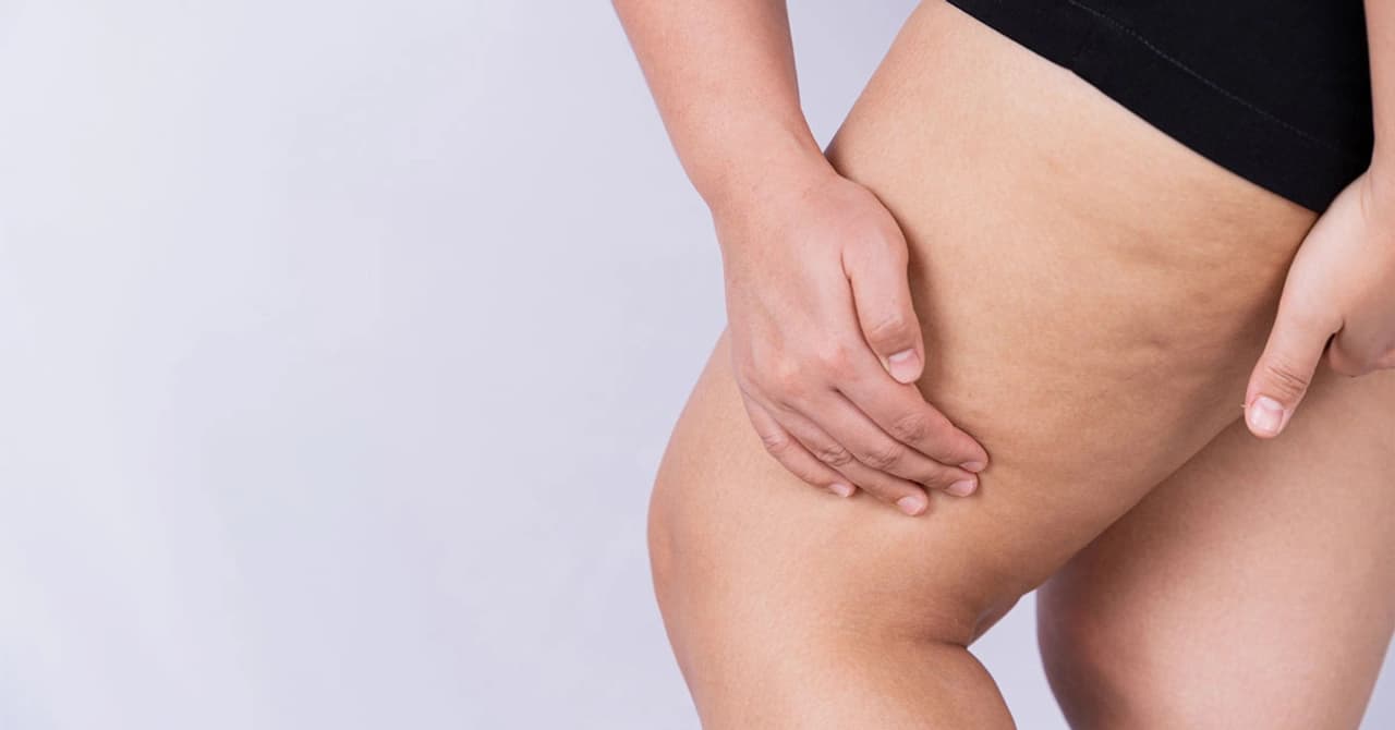 Lipedema Treatment