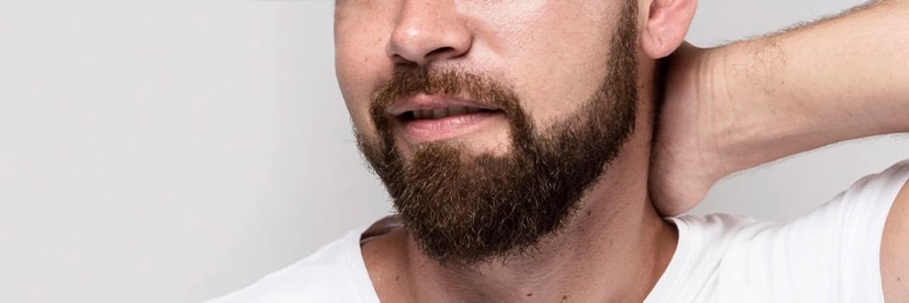 Beard Transplant in Turkey