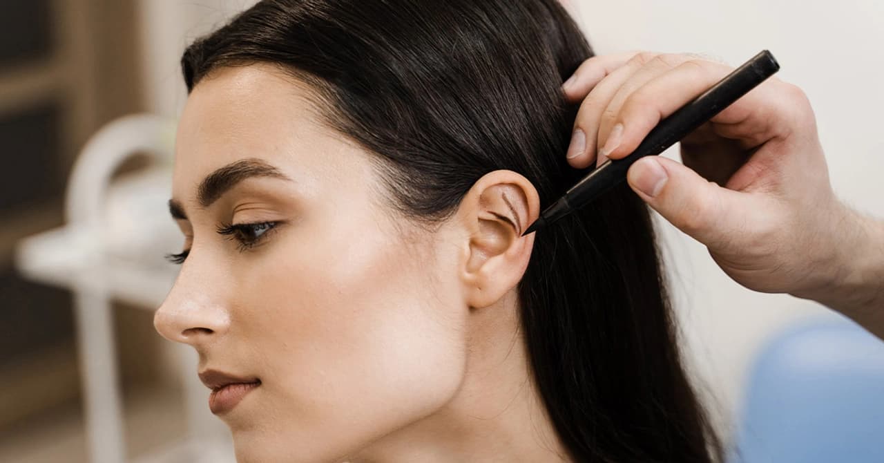 Ear Pinning Back