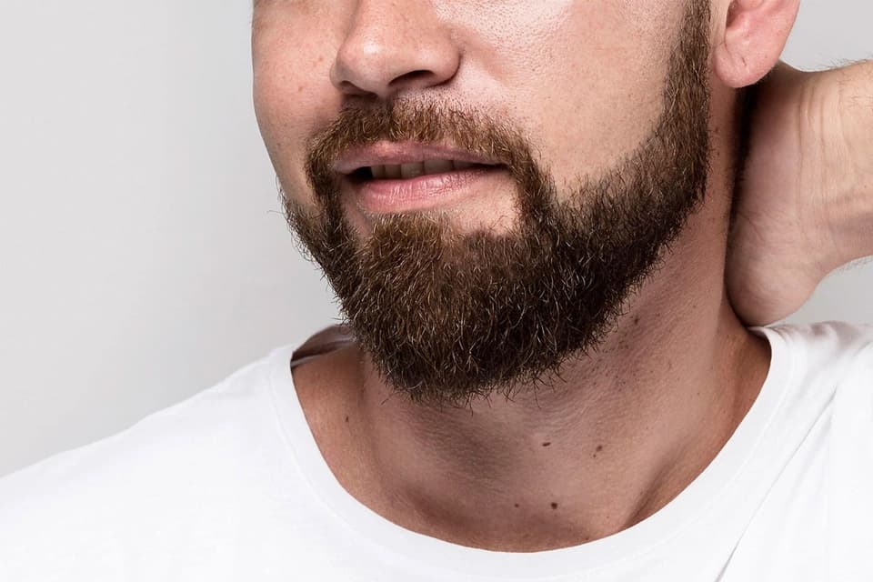 Beard Transplant in Turkey