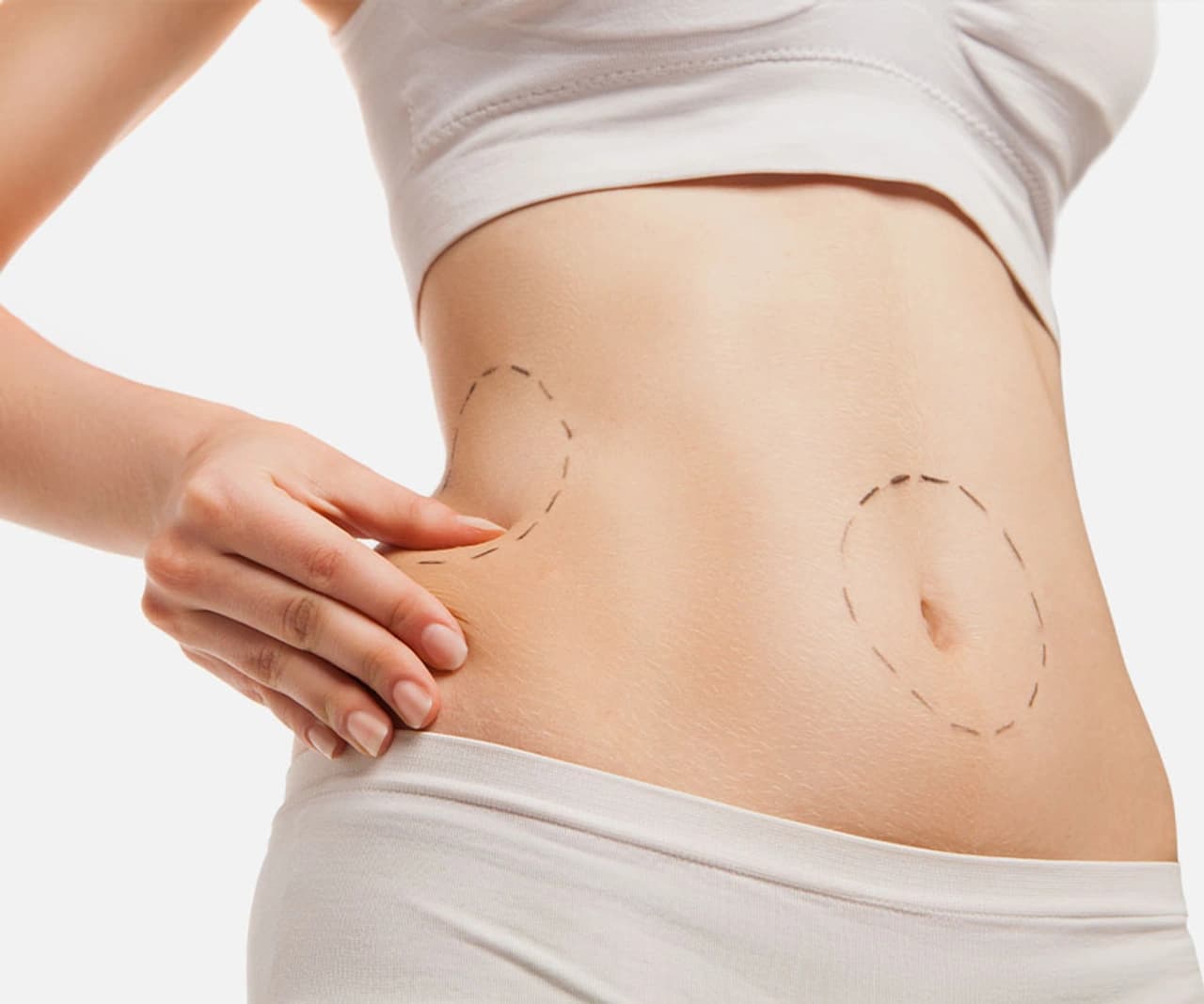 Tummy Tuck (Abdominoplasty) Procedure