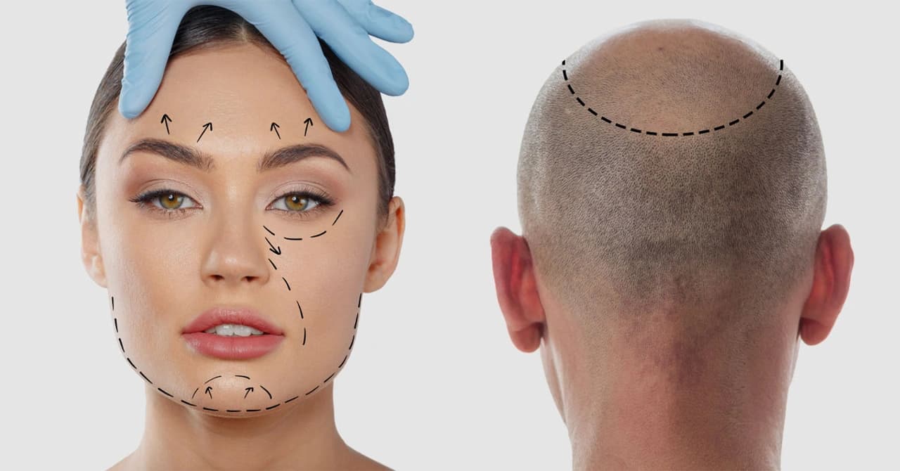 Plastic Surgery or Hair Transplant in Turkey?​