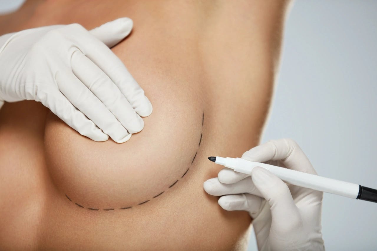 Breast Reduction Surgery in Turkey