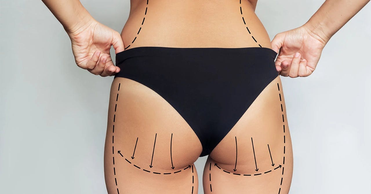 Most Popular Liposuction Types