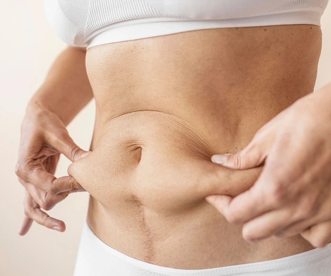 Tummy Tuck (Abdominoplasty) in Turkey