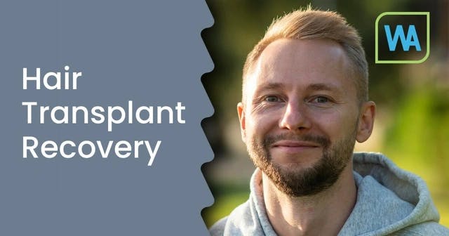 Hair Transplant Recovery Timeline and Procedures
