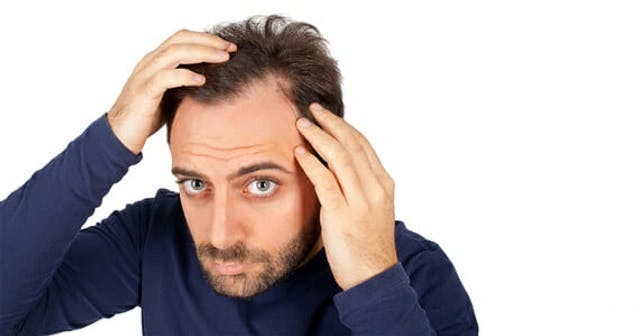 Everything You Need To Know About Hair Transplant Side Effects and How To Prevent Them