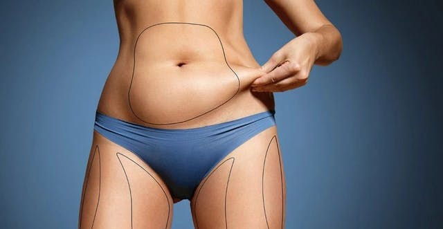 Most Popular Liposuction Types 2022